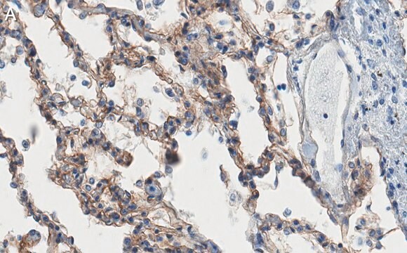 Anti-ITGA3 Antibody, clone 1D6 ZooMAb&#174; Rabbit Monoclonal recombinant, expressed in HEK 293 cells