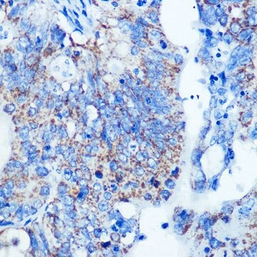 Anti-MMP13 antibody produced in rabbit