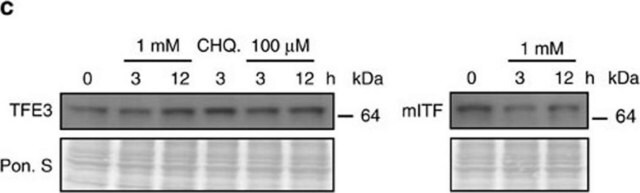 Anti-TFE3 antibody produced in rabbit Prestige Antibodies&#174; Powered by Atlas Antibodies, affinity isolated antibody, buffered aqueous glycerol solution