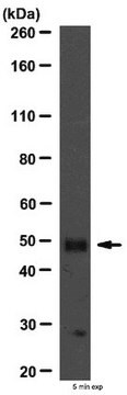 Przeciwciało anty-PKA RII Beta from rabbit, purified by affinity chromatography