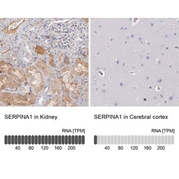 Anti-SERPINA1 antibody produced in rabbit Prestige Antibodies&#174; Powered by Atlas Antibodies, affinity isolated antibody, buffered aqueous glycerol solution