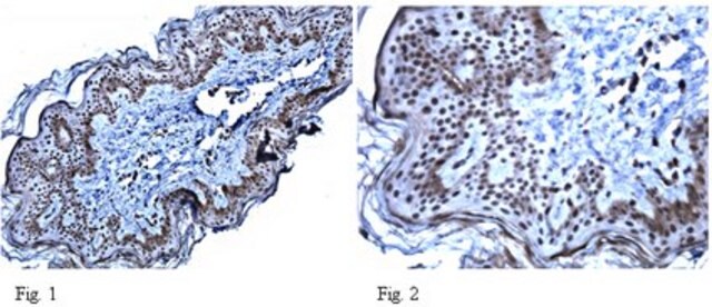 Anti-GPR56 Antibody from rabbit, purified by affinity chromatography