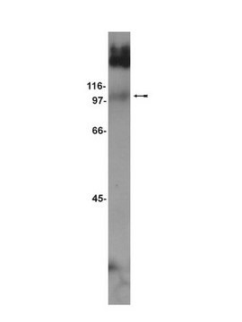 Anticuerpo anti-mGluR7 Upstate&#174;, from rabbit