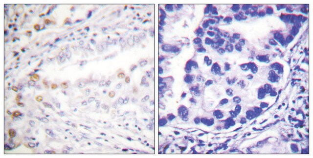 Anti-UBA2 antibody produced in rabbit affinity isolated antibody