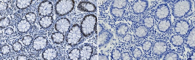 Anti-CDKL5 Antibody, clone 2J15 ZooMAb&#174; Rabbit Monoclonal recombinant, expressed in HEK 293 cells