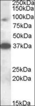 Anti-MARCH10 antibody produced in goat affinity isolated antibody, buffered aqueous solution