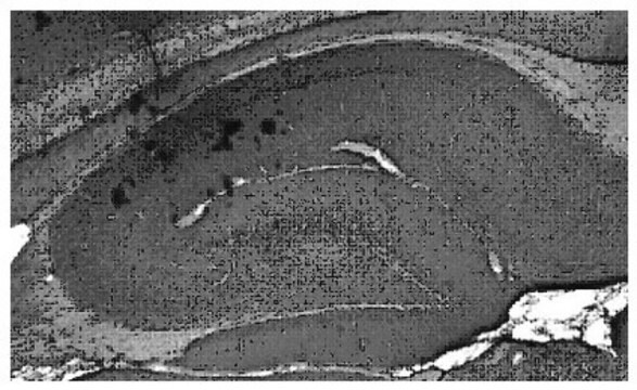 Anti-Natriumkanal-Nav1.7-Antikörper, Klon&nbsp;N68/6 clone N68/6, from mouse