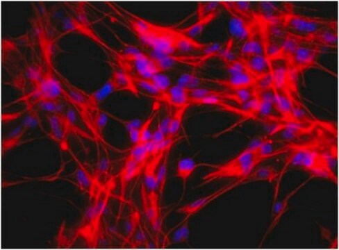 Anti-Nestin Antibody, clone rat-401, Cy3 conjugate clone rat-401, from mouse, CY3 conjugate