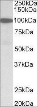 Anti-GSN (N-terminal) antibody produced in goat affinity isolated antibody, buffered aqueous solution