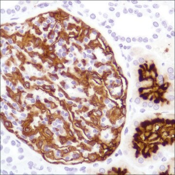 Anti-CD10 antibody, Rabbit monoclonal recombinant, expressed in proprietary host, clone SP179, affinity isolated antibody