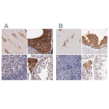 Anti-NSDHL antibody produced in rabbit Ab2, Prestige Antibodies&#174; Powered by Atlas Antibodies, affinity isolated antibody, buffered aqueous glycerol solution