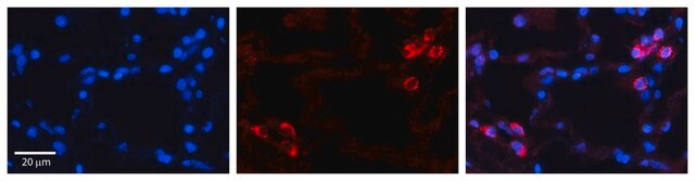 抗-IGFBP7 兔抗 affinity isolated antibody