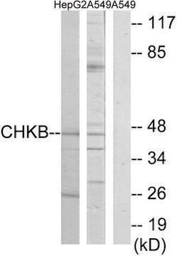 Anti-CHKB antibody produced in rabbit affinity isolated antibody