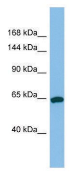 Anti-TPO (N-terminal) antibody produced in rabbit affinity isolated antibody