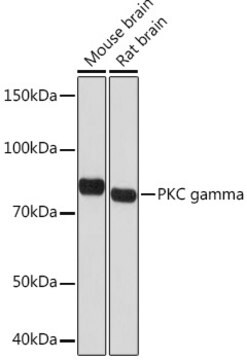 Anti-PKC gamma Antibody, clone 5F2X3, Rabbit Monoclonal