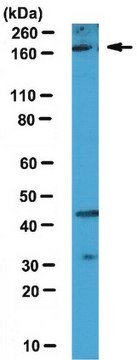 Anti-Set1A Antibody serum, from rabbit