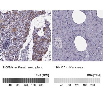 Anti-TRPM7 antibody produced in rabbit Prestige Antibodies&#174; Powered by Atlas Antibodies, affinity isolated antibody