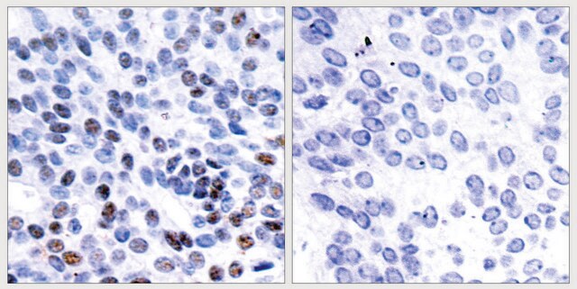 Anti-JUNB antibody produced in rabbit affinity isolated antibody