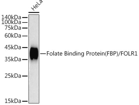 Przeciwciało anty-Folate Binding Protein (FBP) / FOLR1, klon 3J6W3, królicze monoklonalne