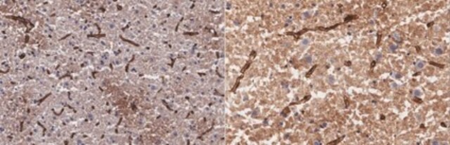 Anti-Aquaporin-4 Antibody, clone mECD clone mECD, from mouse