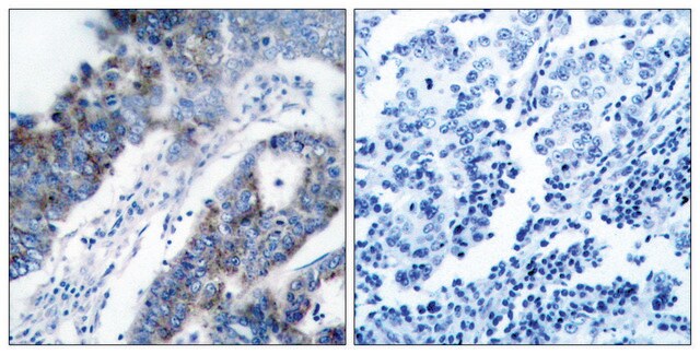 Anti-ASK1 antibody produced in rabbit affinity isolated antibody