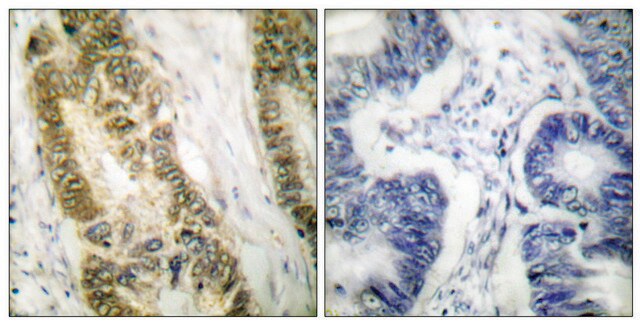 Anti-SP1 antibody produced in rabbit affinity isolated antibody