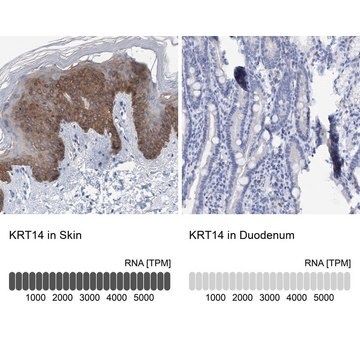 Anti-KRT14 antibody produced in rabbit Prestige Antibodies&#174; Powered by Atlas Antibodies, affinity isolated antibody, buffered aqueous glycerol solution