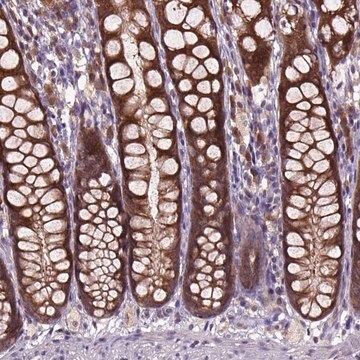 Anty-ARL1 Prestige Antibodies&#174; Powered by Atlas Antibodies, affinity isolated antibody, buffered aqueous glycerol solution