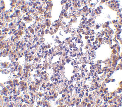 抗PKR抗体 ウサギ宿主抗体 affinity isolated antibody, buffered aqueous solution