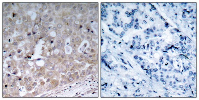 Anti-VEGFR2 antibody produced in rabbit affinity isolated antibody