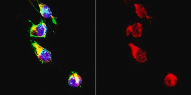 Anti-La-Related Protein 1 from rabbit, purified by affinity chromatography