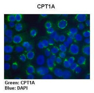 Anti-CPT1A antibody produced in rabbit affinity isolated antibody