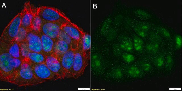 Anti-HIF-2&#945;/EPAS1 Antibody, clone 2L21 ZooMAb&#174; Rabbit Monoclonal recombinant, expressed in HEK 293 cells