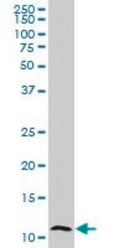 Monoclonal Anti-S100A7 antibody produced in mouse clone 1F8, purified immunoglobulin, buffered aqueous solution