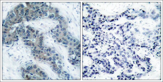 抗-磷酸化-JAK2 (pTyr1007) 兔抗 affinity isolated antibody