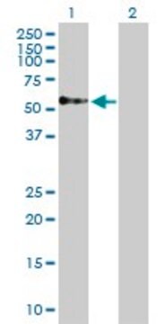 Anti-TOM1 antibody produced in rabbit purified immunoglobulin, buffered aqueous solution