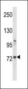 ANTI-MOUSE TEC (CENTER) antibody produced in rabbit IgG fraction of antiserum, buffered aqueous solution