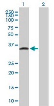 Anti-ATPBD1C antibody produced in mouse purified immunoglobulin, buffered aqueous solution