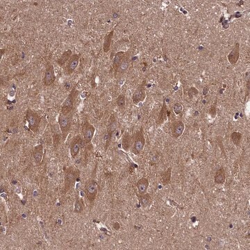 Anti-DOHH antibody produced in rabbit Prestige Antibodies&#174; Powered by Atlas Antibodies, affinity isolated antibody, buffered aqueous glycerol solution