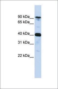 Anti-CARS antibody produced in rabbit affinity isolated antibody