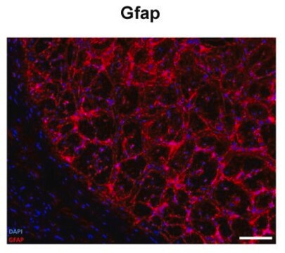 抗 GFAP 兔抗 affinity isolated antibody