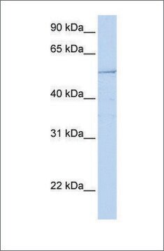 抗HNF1B ウサギ宿主抗体 affinity isolated antibody