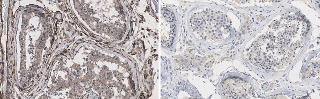 Anti-PDGF-AA Antibody, clone 5C10.8