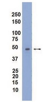 Anti-MAPKAP-K2 Antibody, clone 7H4.2 clone 7H4.2, Upstate&#174;, from mouse