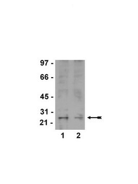 Ral Activation Assay Kit Non-radioactive Ral Activation Assay Kit can be used to precipitate Ral-A-GTP from cell lysates &amp; detection by a Ral-A specific antibody.