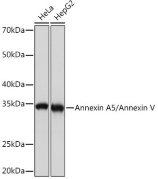 Przeciwciało anty-Annexin A5/Annexin V, klon 9A5M8, królicze monoklonalne