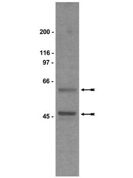 Anticorps anti-Gs&#945; serum, Upstate&#174;