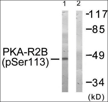 Anti-phospho-PKA-R2&#946; (pSer113) antibody produced in rabbit affinity isolated antibody