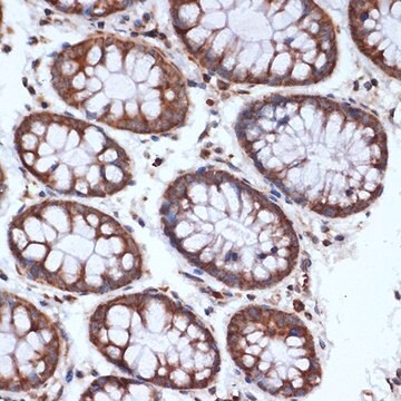 Anti-HSPA14 antibody produced in rabbit