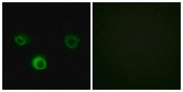 抗CCR4抗体 ウサギ宿主抗体 affinity isolated antibody